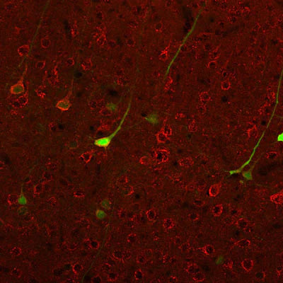 Metabotropic glutamate receptor type 1 (1:1000 dilution, green) immunoreactivity and neurofilament-M (NF-M, rabbit antibody, 1:500 dilution, red) immunoreactivity in a tissue section through the parietal cortex of an e18 mouse embryo.