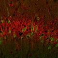 Metabotropic glutamate receptor type 1 (1:1000 dilution, green) immunoreactivity and neurofilament-M (NF-M, rabbit antibody, 1:500 dilution) immunoreactivity in a tissue section through the VSA3 region of the hippocampal formation of an e18 mouse embryo.