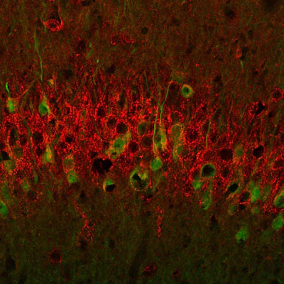 Metabotropic glutamate receptor type 1 (1:1000 dilution, green) immunoreactivity and neurofilament-M (NF-M, rabbit antibody, 1:500 dilution) immunoreactivity in a tissue section through the VSA3 region of the hippocampal formation of an e18 mouse embryo.
