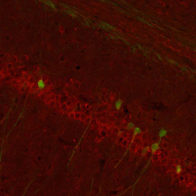 Metabotropic glutamate receptor type 3 (mGluR3, 1:1000 dilution, green) immunoreactivity and neurofilament-M (NF-M rabbit antibody, 1:500 dilution, red) immunoreactivity in a tissue section through the CA3 hippocampal formation of an e18 mouse embryo.