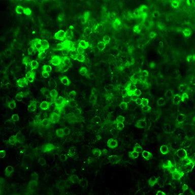 Neurosphere (organoid) cultures of e13 mouse brain were cultured for 2 weeks, and then paraformaldehyde (2%) fixed. After extensive washing, the cultures were incubated with Netrin-1 antibody (Cat. No. NET; 1:500 dilution), washed, and then treated with fluorescein-labeled goat anti-chicken IgY (Aves Cat. No. F-1005; 1:500 dilution). Hoda Ilias, Aves Labs.
