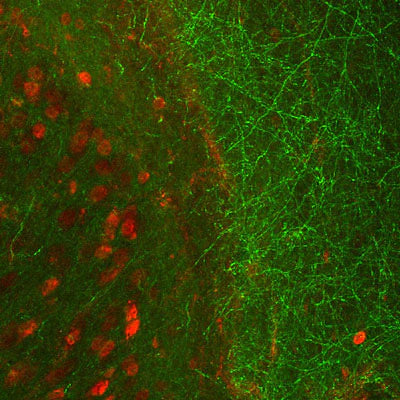 Immunohistochemical photomicrograph of adult mouse cerebral cortex stained for β-tubulin 3 (Rabbit antibody, green; 1:500 dilution) and Neu-N (Chicken antibody from Aves Labs, red, 1:1000 dilution).