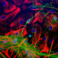 Immunocytochemical staining of NSE (green, 1:1000 dilution) and Glial Fibrillary Acidic Protein (GFAP, rabbit, 1:1000 dilution). Photomicrograph by Dr. Gerry Shaw (EnCor Biotechnology).