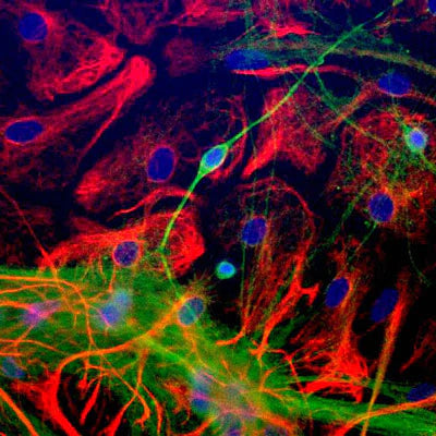 Immunocytochemical staining of NSE (green, 1:1000 dilution) and Glial Fibrillary Acidic Protein (GFAP, rabbit, 1:1000 dilution). Photomicrograph by Dr. Gerry Shaw (EnCor Biotechnology).