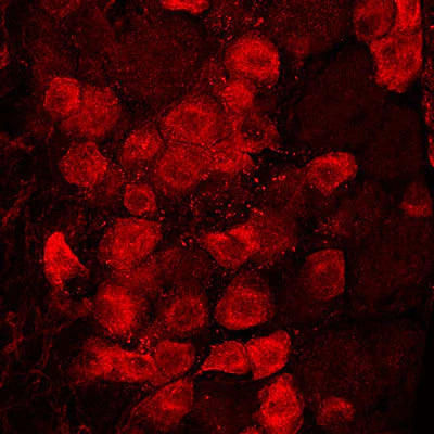 Adult mouse DRG was fixed in 4% paraformaldehyde, cryostat-sectioned, and then stained for PAP immunoreactivity (1:500 dilution), showing immunoreactive material in primary sensory neurons. Photomicrograph by Dr. Mark Zilka, Univ. of North Carolina.