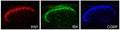 Adult mouse spinal cord was fixed in 4% paraformaldehyde, paraffin-embedded and sectioned, and then sections were stained for PAP immunoreactivity (1:500 dilution). Adjacent sections were co-stained for IB4 and Calcitonin Gene-Related Protein (CGRP) (other sensory neuronal markers). Photomicrograph by Dr. Mark Zilka, University of North Carolina.