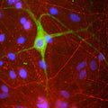 Rat mixed neuron/glial cultures stained with anti-Peripherin (green) and rabbit anti α-internexin (red). Nuclei are stained with DAPI (blue).