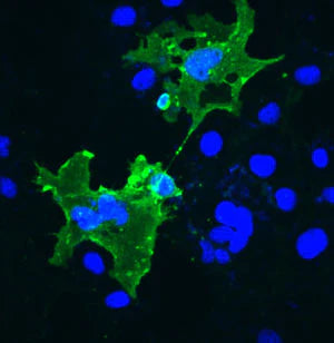 Mouse fibroblast cultures transfected with a recombinant fragment of the mouse prion protein (green staining). Non-infected cells show labeled nuclei (blue staining) due to treatment with Hoechst stain.