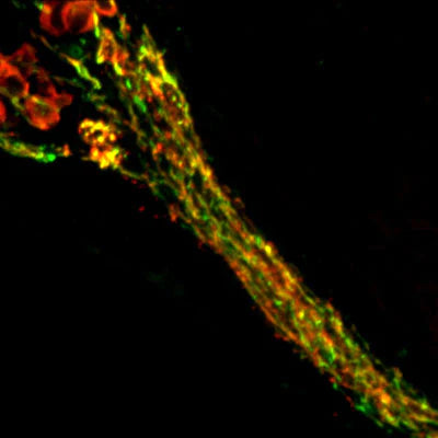 Immunohistochemical staining of Synaptotagmin (green, 1:1000 dilution) and NFH (red, Rockland, 1:500 dilution) in a cryostat section through the Cochlear nerve in an adult mouse.