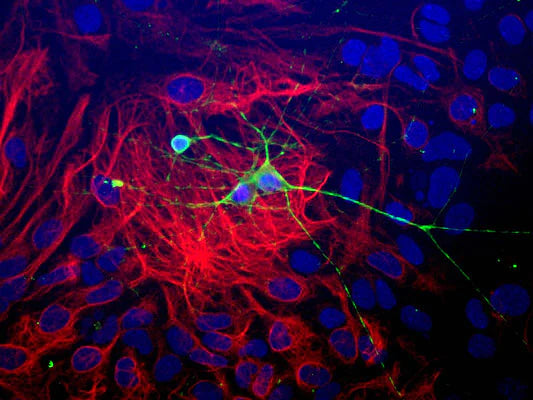Immunostaining of paraformaldehyde-fixed (4%) neonatal mouse brain cultures showing β-Tubulin 3 immunostaining (green, 1:1000 dilution). Red staining is rabbit-anti-GFAP (1:1000); blue is DAPI nuclear counterstain. Secondary antibodies were fluorescein-labeled goat anti-chicken IgY; Texas Red-labeled goat anti-rabbit IgG Dr. Gerry Shaw (EnCor Biotechnology).