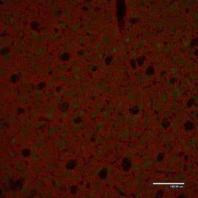 Immunostaining of paraformaldehyde-fixed (4%) paraffin-embedded sections of the caudate nucleus of an adult mouse brain. This mouse was engineered to have GFP expressed under control of the actin promoter, which explains the low-level green autofluorescence. Note the high number of dopaminergic fibers in this brain region. Detection of the chicken antibody came from a Texas Red-labeled goat anti-chicken IgY, 1:500.