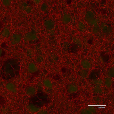 Immunostaining of paraformaldehyde-fixed (4%) paraffin-embedded sections of the caudate nucleus of an adult mouse brain. This mouse was engineered to have GFP expressed under control of the actin promoter, which explains the low-level green autofluorescence. Note the high number of dopaminergic fibers in this brain region. Detection of the chicken antibody came from a Texas Red-labeled goat anti-chicken IgY, 1:500.