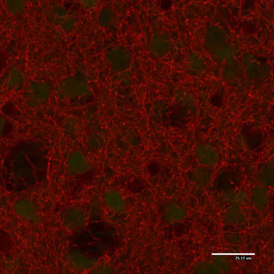 Immunostaining of paraformaldehyde-fixed (4%) paraffin-embedded sections of the caudate nucleus of an adult mouse brain. This mouse was engineered to have GFP expressed under control of the actin promoter, which explains the low-level green autofluorescence. Note the high number of dopaminergic fibers in this brain region. Detection of the chicken antibody came from a Texas Red-labeled goat anti-chicken IgY, 1:500.