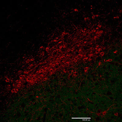 Immunostaining of paraformaldehyde-fixed (4%) paraffin-embedded sections of the substantia nigra pars compacta of an adult mouse brain. This mouse was engineered to have GFP expressed under control of the actin promoter, which explains the low-level green autofluorescence. Note the high number of dopaminergic neuron cell bodies in this brain region. Detection of the chicken antibody came from a Texas Red-labeled goat anti-chicken IgY, 1:500.