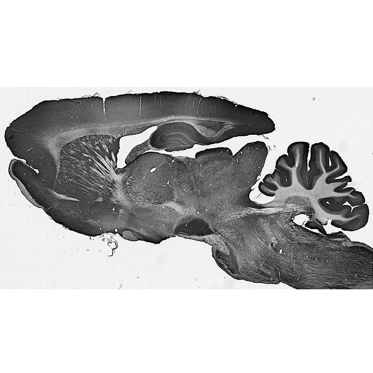 Adult rat brain immunohistochemistry.