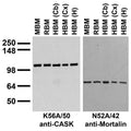 Immunoblot against crude membrane fractions from whole mouse (MBM) or rat (RBM) brain and from human cerebellum [HBM(Cb)], cerebral cortex [HBM(Cx)] or hippocampus [HBM(H)] and probed with K56A/50 (left) or N52A/42 (right) TC supe.