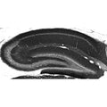 Adult rat hippocampus immunohistochemistry.