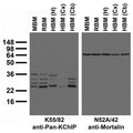 Immunoblot versus crude brain membranes from adult mouse (MBM), rat (RBM) and human hippocampus [HBM(H)], cerebral cortex [HBM(Cx)] and cerebellum [HBM(Cb)] probed with K55/82 (left) and N52A/42 (right) TC supe.