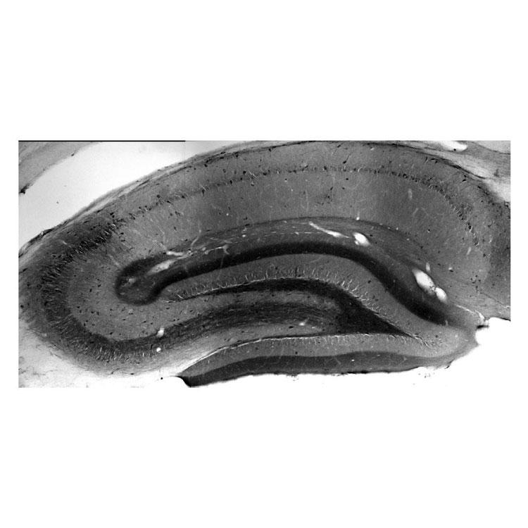 Adult rat hippocampus immunohistochemistry.