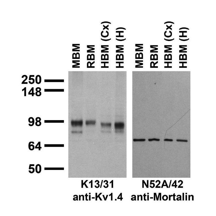 Immunoblot on membrane fractions of whole rat (RBM) and mouse (MBM) brain and from human cerebral cortex [HBM(Cx)] and hippocampus [HBM(H)].