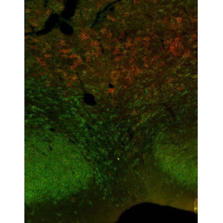 Adult rat basal forebrain immunofluorescence with antigen retrieval via sodium citrate pretreatment with K37/89 (red) and Kv2.1 rabbit (green). Image courtesy of Kaori Misonou and Hiroaki Misonou (University of Maryland, now at Doshisha University, Japan).
