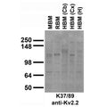 Immunoblot against crude membrane fractions from whole mouse (MBM) or rat (RBM) brain and from human cerebellum [HBM(Cb)], cerebral cortex [HBM(Cx)] or hippocampus [HBM(H)] and probed with K37/89 TC supe.
