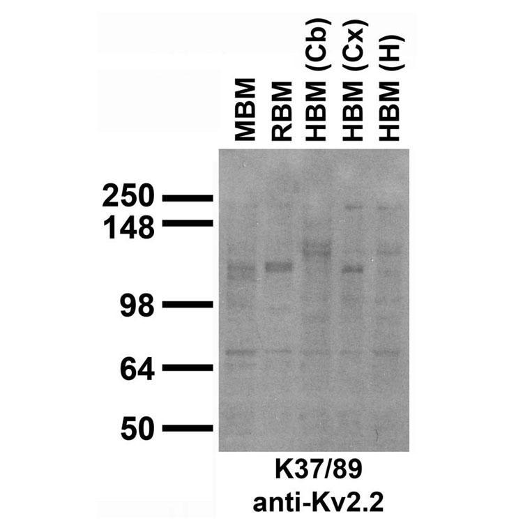 Immunoblot against crude membrane fractions from whole mouse (MBM) or rat (RBM) brain and from human cerebellum [HBM(Cb)], cerebral cortex [HBM(Cx)] or hippocampus [HBM(H)] and probed with K37/89 TC supe.