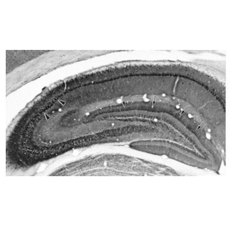 Adult rat hippocampus immunohistochemistry.