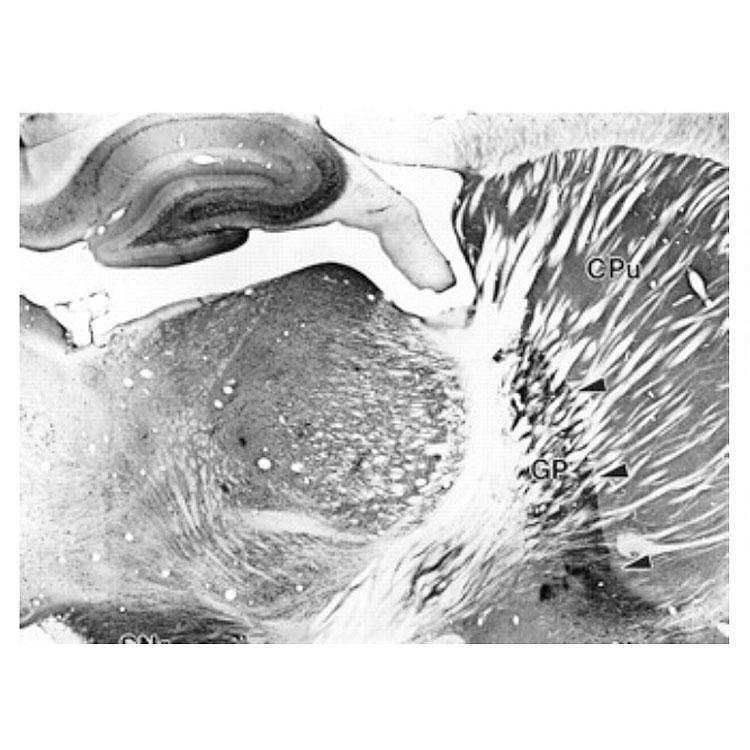 Adult rat striatum immunohistochemistry.