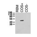 Immunoblot on adult rat brain membrane (RBM) and lysates from Kvβ1.1 -transfected (COS+) and untransfected (COS-) COS cells.