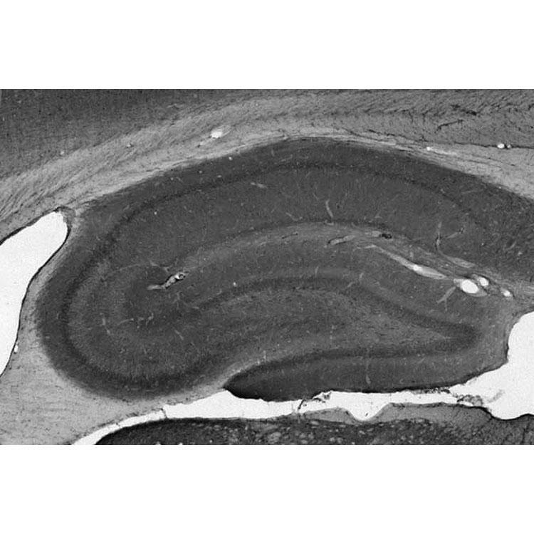 Adult rat hippocampus immunohistochemistry.