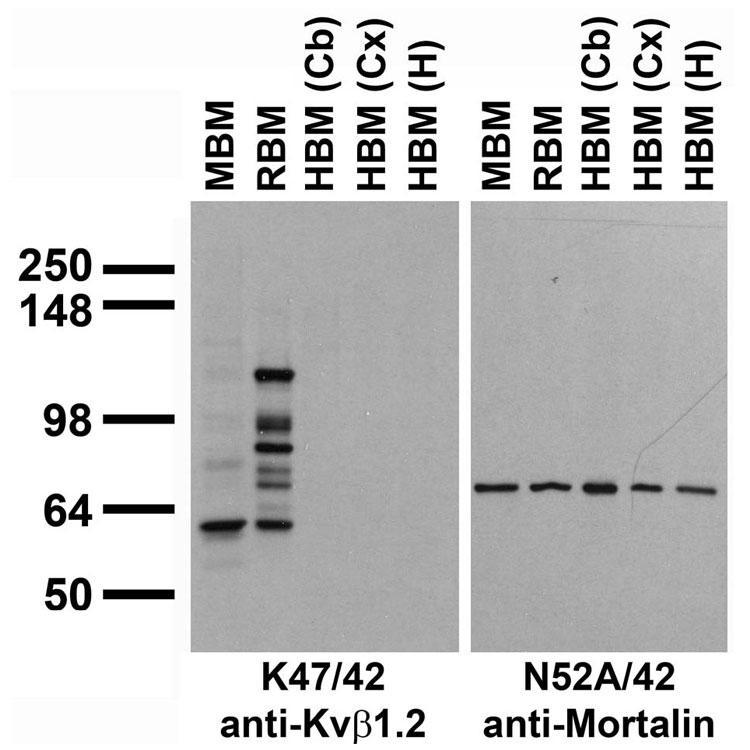 Immunoblot against crude membrane fractions from whole mouse (MBM) or rat (RBM) brain and from human cerebellum [HBM(Cb)], cerebral cortex [HBM(Cx)] or hippocampus [HBM(H)] and probed with K37/89 (left) or N52A/42 (right) TC supe.