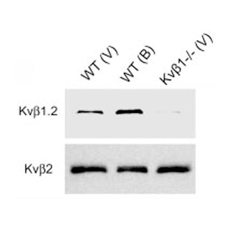 Immunoblot of crude membrane fractions from adult heart ventricle (V) and brain (B) from wild-type (WT) and Kvß1 knockout (Kvβ1) mice probed with K47/42 (Kvβ1.2, top) and K17/70 (Kvβ2, bottom). Data courtesy of Jeanne Nerbonne, Washington University SOM. Reproduced with permission from 2005 Aimond et al. Circ Res.
