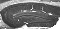 Adult rat hippocampus immunohistochemistry.