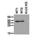 Immunoblot on adult mouse brain membranes from two wild-type (WT1,2) and Kvβ2 knockout (Kvβ2 KO) mice. Brain samples courtesy of Dr. Geoff Murphy, Molecular and Behavioral Neuroscience Institute, University of Michigan.
