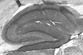 Adult rat hippocampus immunohistochemistry