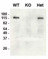 Immunoblot versus brain lysates from SAP97 wild-type (WT), knockout (KO) and heterozygous (Het) adult mice using K64/15 pure at 1 µg/mL (data courtesy of Lauren Makuch and Dr. Richard Huganir, Johns Hopkins University School of Medicine).