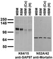 Immunoblots on brain membranes prepares from whole rat (RBM) and mouse (MBM) brain, and from human cerebral cortex [HBM(Cx)], and hippocampus [HBM(H)]
