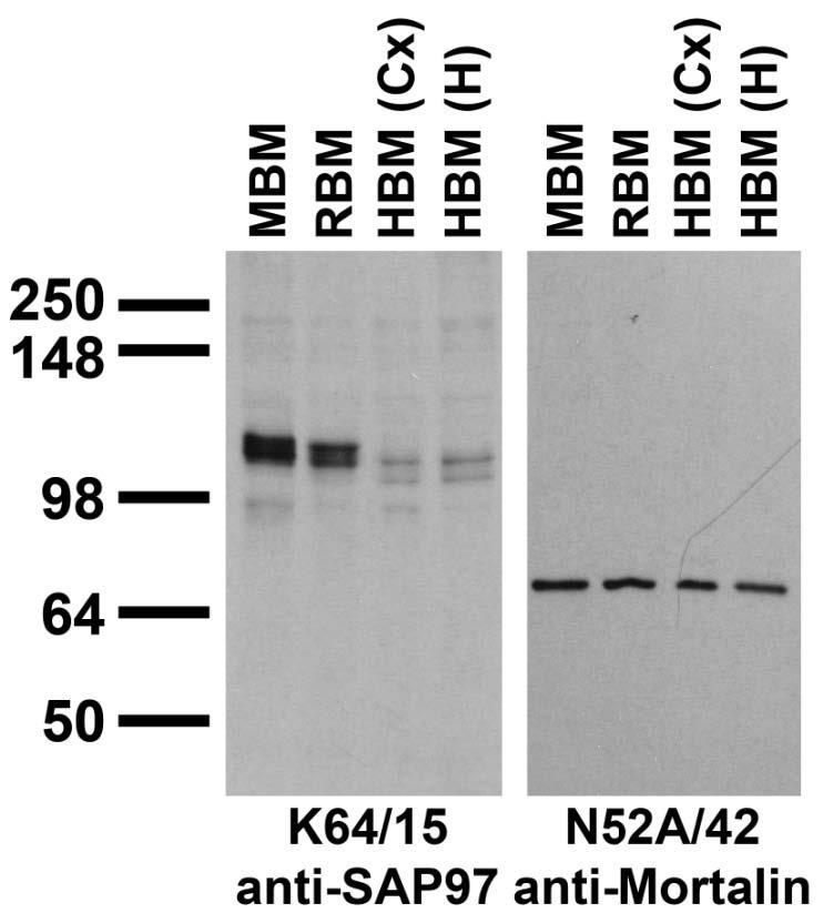 Immunoblots on brain membranes prepares from whole rat (RBM) and mouse (MBM) brain, and from human cerebral cortex [HBM(Cx)], and hippocampus [HBM(H)]
