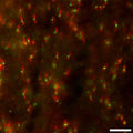 Immunofluorescence staining of adult rat optic nerve with K73/20 (red) and βIV-spectrin rabbit polyclonal (green). Image courtesy of Matt Rasband (Baylor College of Medicine).