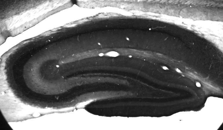 Adult rat hippocampus immunohistochemistry.