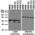 Immunoblot against crude membrane fractions from whole mouse (MBM) or rat (RBM) brain and from human hippocampus [HBM(H)], cerebral cortex [HBM(Cx)] or cerebellum [HBM(Cb)] and probed with L20/8 (left) or N52A/42 (right) TC supe.