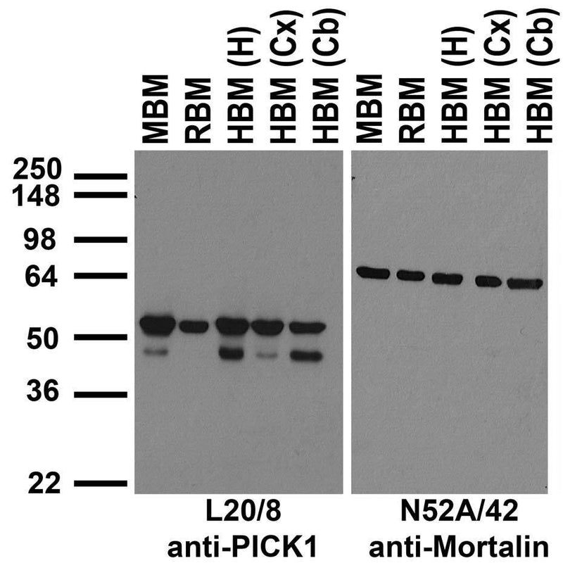 Immunoblot against crude membrane fractions from whole mouse (MBM) or rat (RBM) brain and from human hippocampus [HBM(H)], cerebral cortex [HBM(Cx)] or cerebellum [HBM(Cb)] and probed with L20/8 (left) or N52A/42 (right) TC supe.