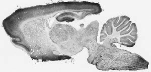 Adult rat whole brain immunohistochemistry.