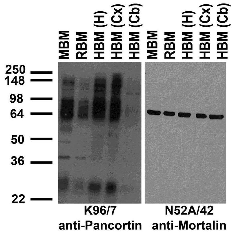 Immunoblot against crude membrane fractions from whole mouse (MBM) or rat (RBM) brain and from human hippocampus [HBM(H)], cerebral cortex [HBM(Cx)] or cerebellum [HBM(Cb)] and probed with K96/7 (left) or N52A/42 (right) TC supe.