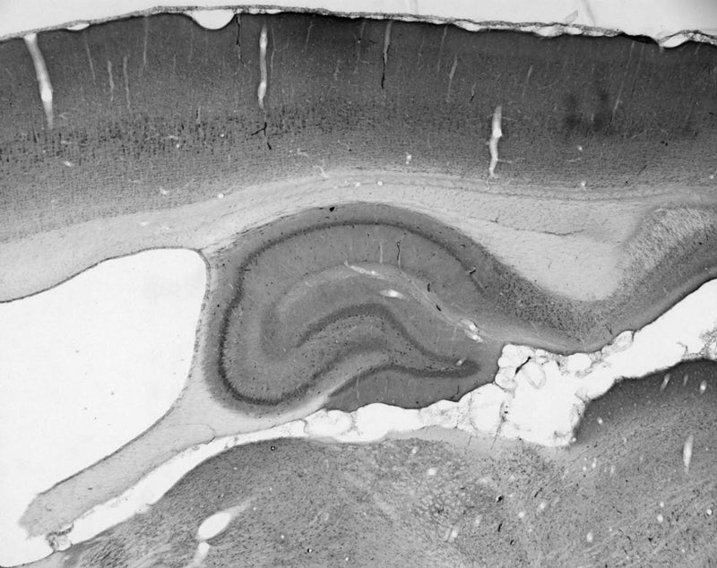 Adult rat hippocampus immunohistochemistry.