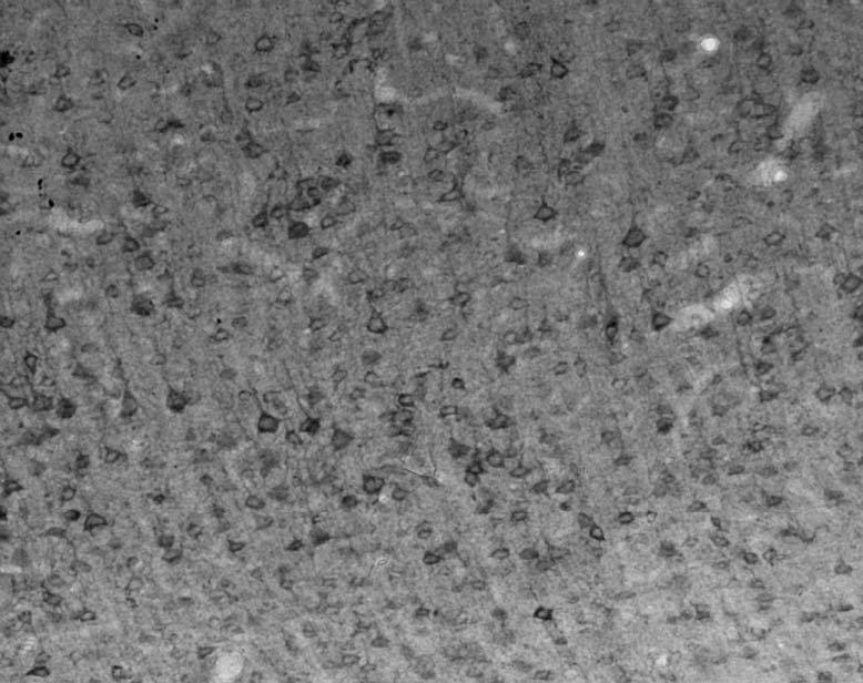 Adult rat cortex immunohistochemistry.