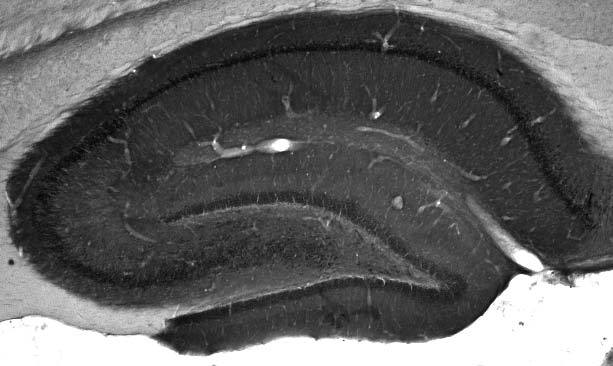 Adult rat hippocampus immunohistochemistry.