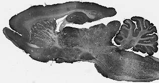 Adult rat whole brain immunohistochemistry.