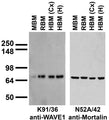 Immunoblot against crude membrane fractions from whole mouse (MBM) or rat (RBM) brain and from human cerebral cortex [HBM(Cx)] or hippocampus [HBM(H)] and probed with K91/36 (left) or N52A/42 (right) TC supe.